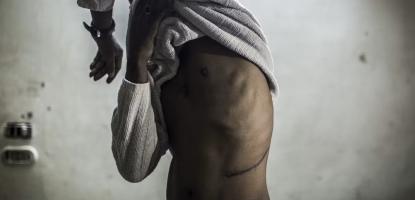 بيع الاعضاء